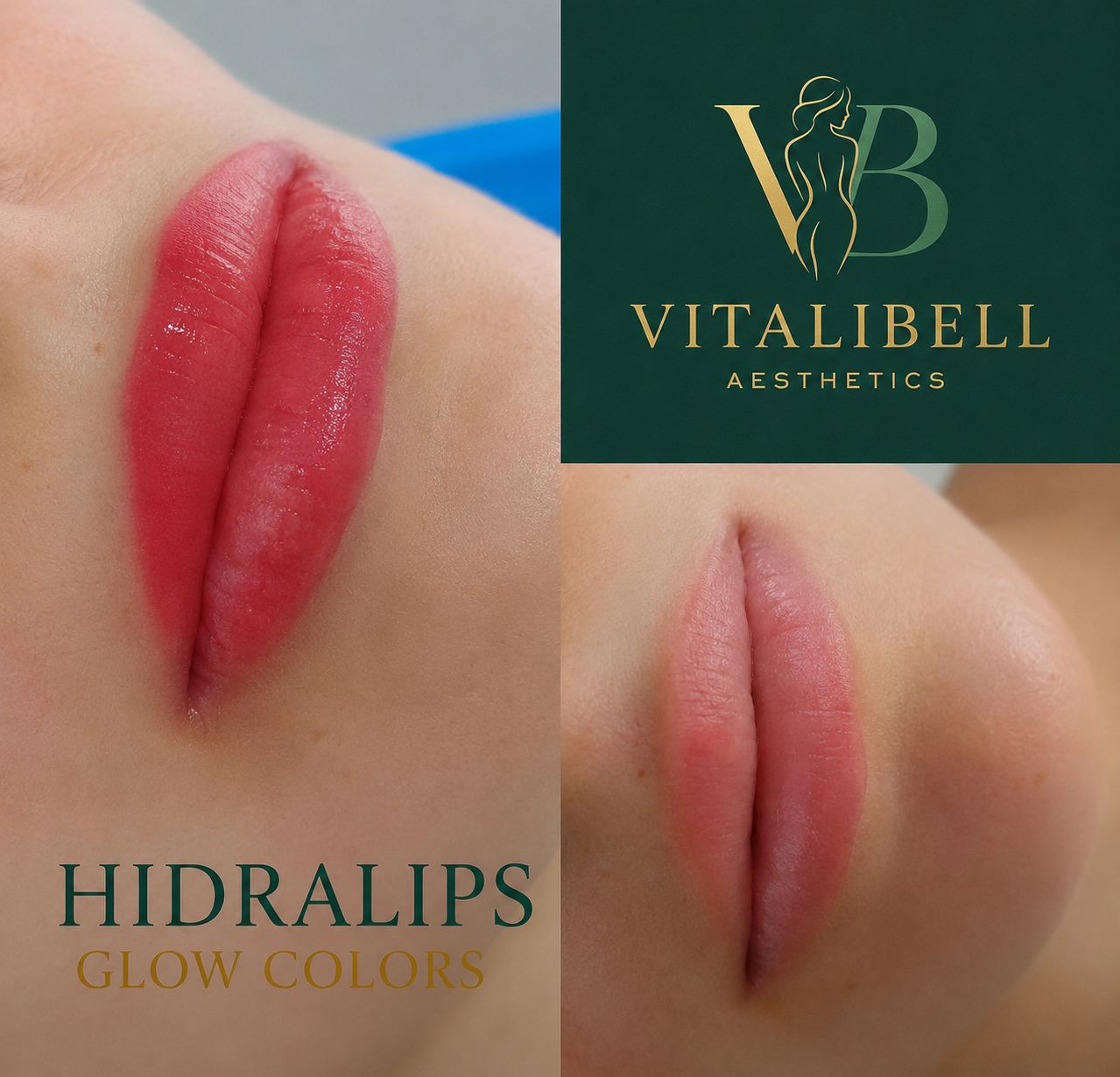 Hydralips Glow — tratamiento hidratante de labios